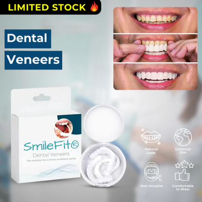 SmileFit® – Natural Removable Dental Veneers [BUY 1, GET 2 FREE]